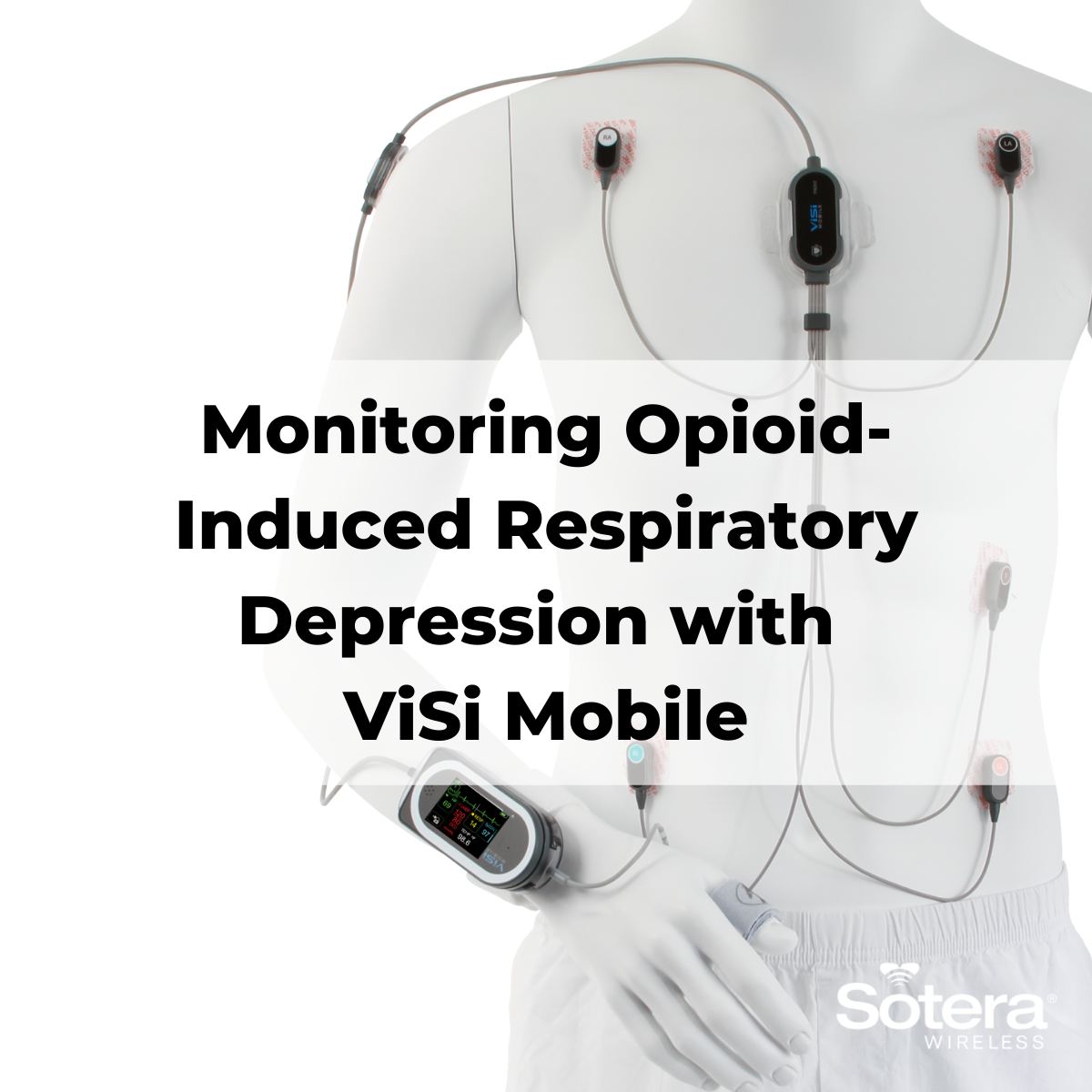 Monitoring OpioidInduced Respiratory Depression with ViSi Mobile